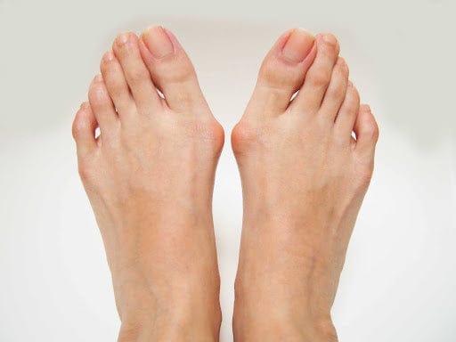 Pain During Walking or Standing