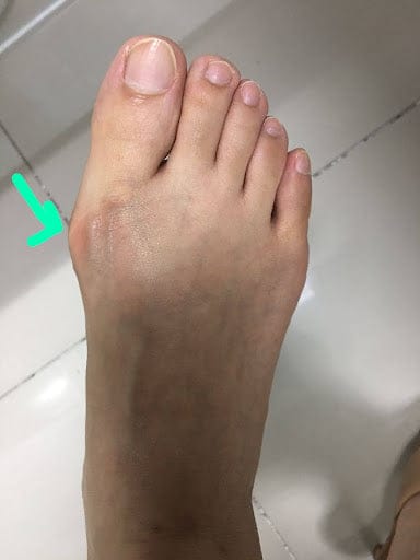 Limited Footwear Options